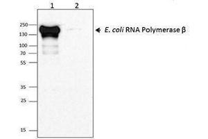 anti-RNA Polymerase beta antibody