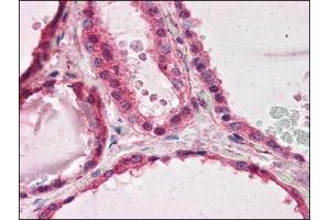 Human Thyroid (formalin-fixed, paraffin-embedded) stained with PAFAH1B1at 3. (PAFAH1B1 anticorps  (C-Term))