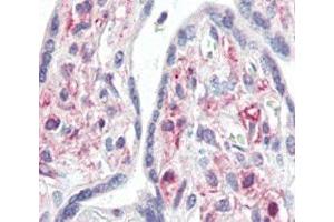 IHC analysis of FFPE human placenta tissue stained with IRAK antibody (IRAK1 anticorps  (AA 683-712))