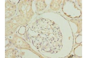 Immunohistochemistry of paraffin-embedded human kidney tissue using ABIN7170672 at dilution of 1:100 (SLA anticorps  (AA 2-276))