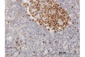 Immunoperoxidase of purified MaxPab antibody to CHAF1B on formalin-fixed paraffin-embedded human lymph node.
