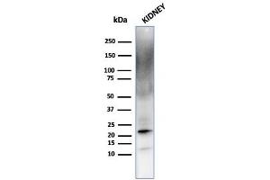 anti-Ferritin, Light Polypeptide (FTL) (AA 38-165) antibody