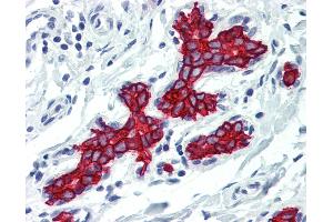 Anti-Cytokeratin 19 antibody IHC of human breast. (Cytokeratin 19 anticorps)