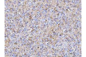 IHC analysis of PTN using anti-PTN antibody (ABIN7602164). (Pleiotrophin anticorps  (AA 61-148))