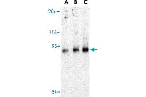 Western blot analysis of TRPC6 in mouse lung tissue lysate with TRPC6 polyclonal antibody  at (A) 0. (TRPC6 anticorps  (C-Term))