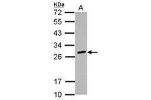 Image no. 2 for anti-Major Histocompatibility Complex, Class II, DQ beta 2 (HLA-DQB2) antibody (ABIN1498674) (HLA-DQB2 anticorps)