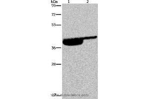 Western blot analysis of Human bladder and bladder transitional cell carcinoma tissue, using P2RX3 Polyclonal Antibody at dilution of 1:250