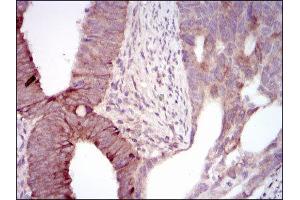 Immunohistochemistry (IHC) image for anti-Maternal Embryonic Leucine Zipper Kinase (MELK) (AA 637-651) antibody (ABIN1844288)