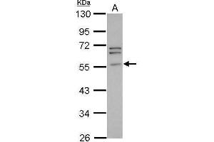 WB Image Sample (30 ug of whole cell lysate) A: PC-3 10% SDS PAGE antibody diluted at 1:1000 (Peripherin anticorps)