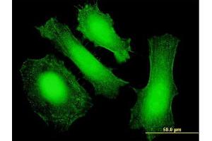 Immunofluorescence of purified MaxPab antibody to LIN28 on HeLa cell.