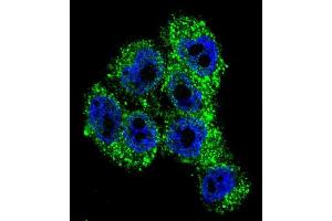 Confocal immunofluorescent analysis of TRPM8 Antibody (Center) with A375 cell followed by Alexa Fluor 488-conjugated goat anti-rabbit lgG (green).