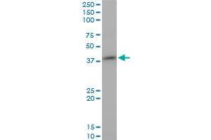 STYK1 monoclonal antibody (M02), clone 3D2.