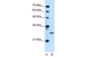 Image no. 1 for anti-Podoplanin (PDPN) (AA 97-146) antibody (ABIN6736674) (Podoplanin anticorps  (AA 97-146))