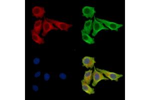 ABIN7097105 and ABIN7101172 staining Hela cells by IF/ICC.
