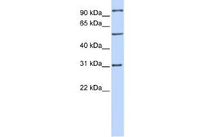 WB Suggested Anti-RAI14 Antibody Titration: 0. (RAI14 anticorps  (Middle Region))
