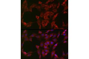 Immunofluorescence analysis of NIH/3T3 cells using NQO1 Rabbit pAb (ABIN1681096, ABIN3015018, ABIN3015019 and ABIN6213595) at dilution of 1:50 (40x lens).