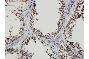 Image no. 3 for anti-PDZ Binding Kinase (PBK) (AA 1-110) antibody (ABIN599275) (PBK anticorps  (AA 1-110))