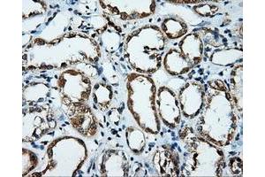 Immunohistochemical staining of paraffin-embedded Kidney tissue using anti-PLEK mouse monoclonal antibody. (Pleckstrin anticorps)
