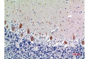 Immunohistochemistry (IHC) analysis of paraffin-embedded Human Brain, antibody was diluted at 1:100. (KIR3DL1 anticorps)