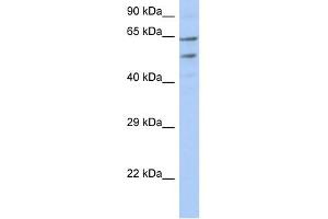 TMCC3 antibody used at 1 ug/ml to detect target protein. (TMCC3 anticorps  (N-Term))