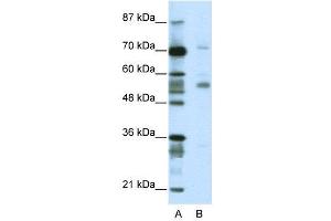 WB Suggested Anti-CORO1A  Antibody Titration: 2. (Coronin 1a anticorps  (N-Term))