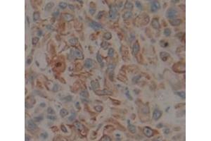IHC-P analysis of Human Tissue, with DAB staining. (CYP1A1 anticorps  (AA 1-250))