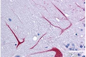 Anti-BANP antibody IHC staining of human brain, cerebellum. (BANP anticorps  (Internal Region))