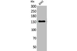 Western Blot analysis of K562 cells using CD50 Polyclonal Antibody (ICAM-3/CD50 anticorps  (Internal Region))