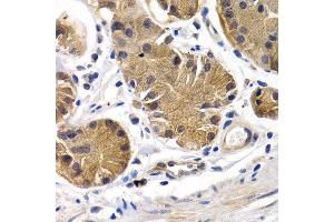 Immunohistochemistry of paraffin-embedded human stomach using PTGIR antibody.