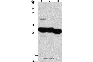 Western blot analysis of Mouse liver and kidney tissue, human fetal liver tissue, using KHK Polyclonal Antibody at dilution of 1:1250 (Ketohexokinase anticorps)