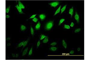Immunofluorescence of monoclonal antibody to TESK2 on HeLa cell. (TESK2 anticorps  (AA 405-542))