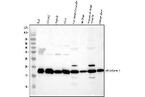 Western blot analysis of Cofilin 2 using anti-Cofilin 2 antibody (ABIN4886538).