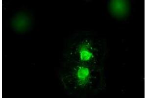 Image no. 7 for anti-Mitogen-Activated Protein Kinase Kinase 4 (MAP2K4) antibody (ABIN1499480)