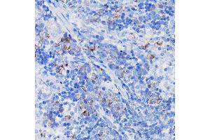 Immunohistochemistry of paraffin-embedded rat spleen using Clusterin alpha chain Rabbit pAb (ABIN6133477, ABIN6138756, ABIN6138758 and ABIN6216721) at dilution of 1:100 (40x lens). (Clusterin anticorps  (AA 23-120))