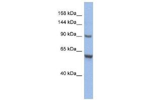 WB Suggested Anti-CIZ1  Antibody Titration: 0.