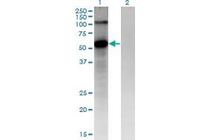 Western Blot analysis of FZD4 expression in transfected 293T cell line by FZD4 monoclonal antibody (M02), clone 3G7. (FZD4 anticorps  (AA 107-206))