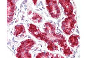 Anti-RIG-1 / RIG-I antibody IHC of human breast. (DDX58 anticorps  (AA 200-250))