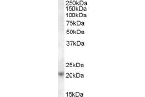 ABIN238604 (1µg/ml) staining of Jurkat cell lysate (35µg protein in RIPA buffer).