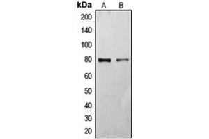 Western blot analysis of Frizzled 6 expression in HT29 (A), HeLa (B) whole cell lysates. (FZD6 anticorps  (Center))