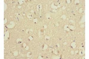 Immunohistochemistry of paraffin-embedded human brain tissue using ABIN7142540 at dilution of 1:100 (RPS27 anticorps  (AA 1-84))
