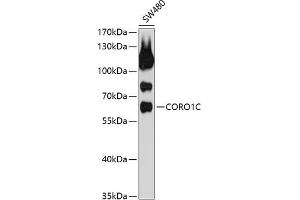Western blot analysis of extracts of SW480 cells, using CORO1C antibody (ABIN1679327, ABIN3019058, ABIN3019059 and ABIN6220690) at 1:1000 dilution. (CORO1C anticorps  (AA 375-474))