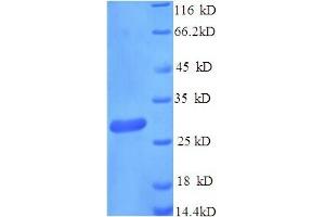 SDS-PAGE (SDS) image for CD163 (CD163) (AA 86-365), (partial) protein (His tag) (ABIN5714360)