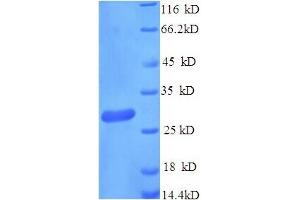 SDS-PAGE (SDS) image for CD163 (CD163) (AA 86-365), (partial) protein (His tag) (ABIN5714360) (CD163 Protein (CD163) (AA 86-365, partial) (His tag))