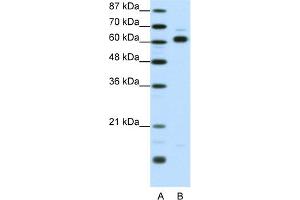 WB Suggested Anti-TRIP4 Antibody Titration:  1. (TRIP4 anticorps  (Middle Region))