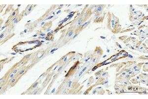 IHC analysis of MT-ND5 using anti-MT-ND5 antibody (ABIN7600145). (MT-ND5 anticorps  (AA 154-570))
