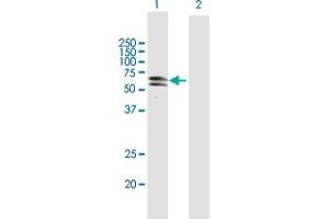 Western Blot analysis of PKNOX1 expression in transfected 293T cell line by PKNOX1 MaxPab polyclonal antibody. (PKNOX1 anticorps  (AA 1-436))