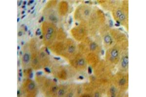 Used in DAB staining on fromalin fixed paraffin-embedded Liver tissue