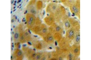 Used in DAB staining on fromalin fixed paraffin-embedded Liver tissue (GDF11 anticorps  (AA 138-386))