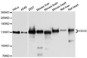 Western blot analysis of extracts of various cell lines, using CDH2 antibody. (N-Cadherin anticorps  (AA 750-850))