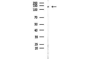 Western blot analysis of lysates from Rat brain, using HER2/Erb Antibody at 1/1000 dilution.